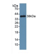 Western blot analysis of recombinant Mouse PDGFRb.