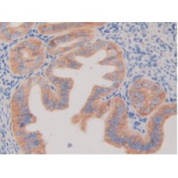 Platelet Derived Growth Factor Receptor Beta (PDGFRB) Antibody