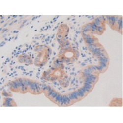 Platelet Derived Growth Factor Receptor Beta (PDGFRB) Antibody