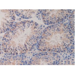 Platelet Derived Growth Factor Receptor Beta (PDGFRB) Antibody