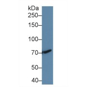 Western blot analysis of Human HepG2 cell lysate, using Rat TGFbR3 Antibody (2 µg/ml) and HRP-conjugated Goat Anti-Rabbit antibody (<a href="https://www.abbexa.com/index.php?route=product/search&amp;search=abx400043" target="_blank">abx400043</a>, 0.2 µg/ml).