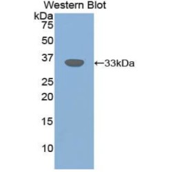 Transforming Growth Factor Beta Receptor III (TGFbR3) Antibody