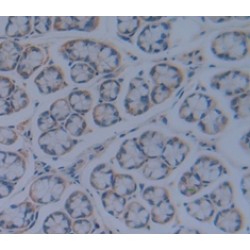 Transforming Growth Factor Beta Receptor III (TGFbR3) Antibody