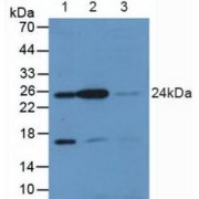 Western blot analysis of (1) Rat Placenta Tissue, (2) Rat Brain Tissue and (3) Rat Bladder Tissue.