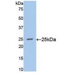 V-Ral Simian Leukemia Viral Oncogene Homolog A (RALA) Antibody