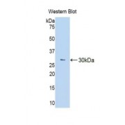 Western blot analysis of the recombinant protein.