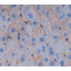 Colony Stimulating Factor Receptor, Macrophage (MCSFR) Antibody