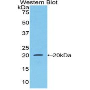 Western blot analysis of the recombinant protein.