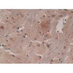 Colony Stimulating Factor Receptor, Macrophage (MCSFR) Antibody