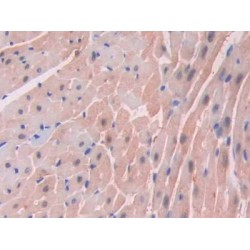 Fatty Acid Binding Protein 3, Muscle And Heart (FABP3) Antibody