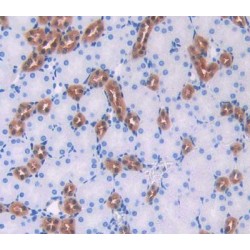 Fatty Acid Binding Protein 3, Muscle And Heart (FABP3) Antibody