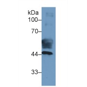 Western blot analysis of Human Placenta lysate, using Human KRT19 Antibody (2 µg/ml) and HRP-conjugated Goat Anti-Mouse antibody (<a href="https://www.abbexa.com/index.php?route=product/search&amp;search=abx400001" target="_blank">abx400001</a>, 0.2 µg/ml).