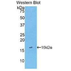 Fatty Acid Binding Protein 3, Muscle And Heart (FABP3) Antibody