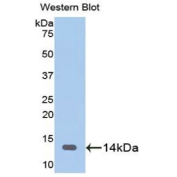 Fatty Acid Binding Protein 3, Muscle And Heart (FABP3) Antibody