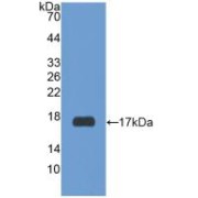 Western blot analysis of recombinant Human RXFP1.