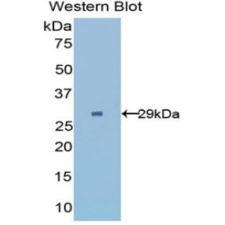 UDP-Glucose Glycoprotein Glucosyltransferase 2 (UGGT2) Antibody