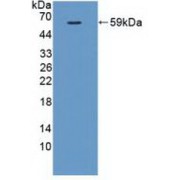 Western blot analysis of recombinant Pig VEGFR1.