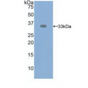 Western blot analysis of recombinant Human VEGFR2.