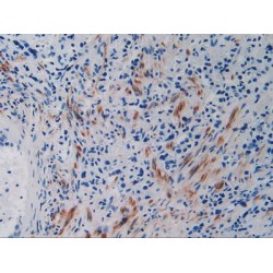 Vascular Endothelial Growth Factor Receptor 2 / VEGFR2 (KDR) Antibody