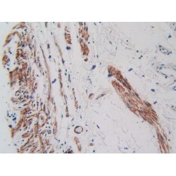 Vascular Endothelial Growth Factor Receptor 2 / VEGFR2 (KDR) Antibody