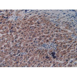 Vascular Endothelial Growth Factor Receptor 2 / VEGFR2 (KDR) Antibody