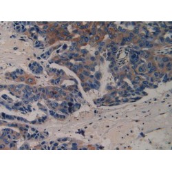 Vascular Endothelial Growth Factor Receptor 2 / VEGFR2 (KDR) Antibody