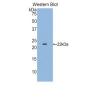 Western blot analysis of the recombinant protein.