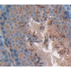 Colony Stimulating Factor Receptor, Granulocyte (GCSFR) Antibody