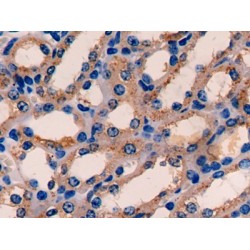 Electron Transfer Flavoprotein Alpha Polypeptide (ETFa) Antibody