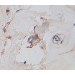 Killer Cell Immunoglobulin Like Receptor 2DL1 (KIR2DL1) Antibody