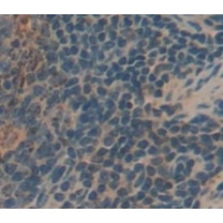 Killer Cell Immunoglobulin Like Receptor 2DS4 (KIR2DS4) Antibody