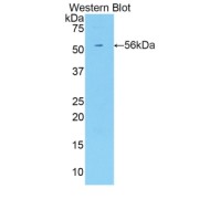 Western blot analysis of the recombinant protein.