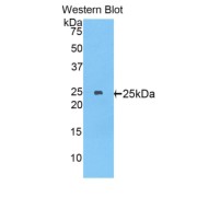 Western blot analysis of the recombinant protein.