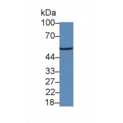 Western blot analysis of Mouse Cerebrum lysate, using Human NR3C1 Antibody (5 µg/ml) and HRP-conjugated Goat Anti-Rabbit antibody (<a href="https://www.abbexa.com/index.php?route=product/search&amp;search=abx400043" target="_blank">abx400043</a>, 0.2 µg/ml).