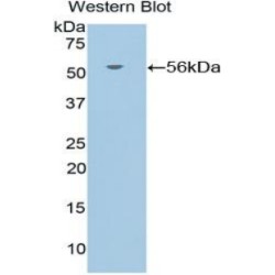 Glucocorticoid Receptor (NR3C1) Antibody