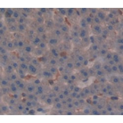 Glucocorticoid Receptor (NR3C1) Antibody