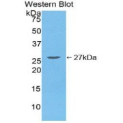 Western blot analysis of the recombinant protein.