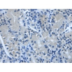 Transforming Growth Factor Beta Induced Protein (TGFbI) Antibody