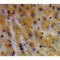 Transforming Growth Factor Beta Induced Protein (TGFbI) Antibody