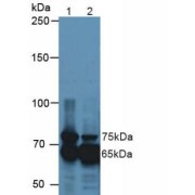 Western blot analysis of (1) Mouse Kidney Tissue and (2) Mouse Eye Tissue, using Transforming Growth Factor Beta Induced Protein (TGFbI) Antibody.