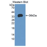 Western blot analysis of the recombinant protein.