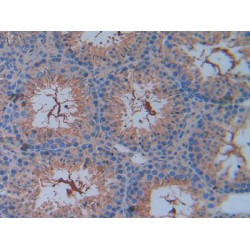 Basigin (BSG) Antibody