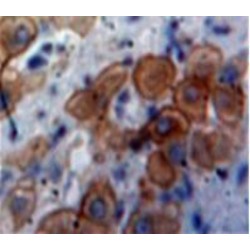 Interferon Inducible T-Cell Alpha Chemoattractant (ITaC) Antibody