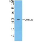 Western blot analysis of recombinant Human LAT2.