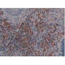 Linker For Activation of T-Cells Family, Member 2 (LAT2) Antibody