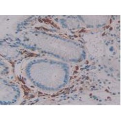 Linker For Activation of T-Cells Family, Member 2 (LAT2) Antibody