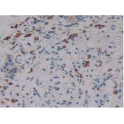 Linker For Activation of T-Cells Family, Member 2 (LAT2) Antibody