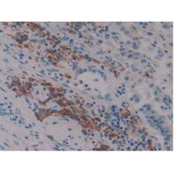 Linker For Activation of T-Cells Family, Member 2 (LAT2) Antibody