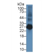 Western blot analysis of Rat Spleen lysate, using Rat LAT2 Antibody (2 µg/ml) and HRP-conjugated Goat Anti-Rabbit antibody (<a href="https://www.abbexa.com/index.php?route=product/search&amp;search=abx400043" target="_blank">abx400043</a>, 0.2 µg/ml).