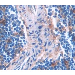 Linker For Activation of T-Cells Family, Member 2 (LAT2) Antibody